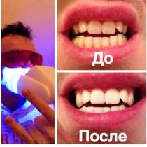 Салон косметического отбеливания зубов, в Мурманске