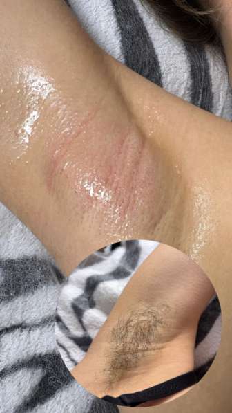 Spa-Шугаринг в Обнинске фото 3