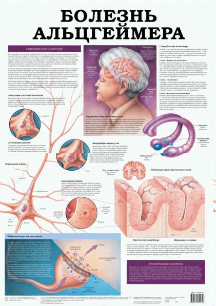 Медицинский информационный плакат в фото 21