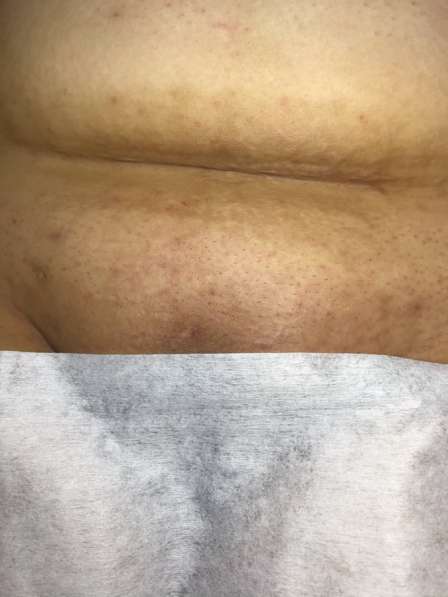 Шугаринг в Ростове-на-Дону