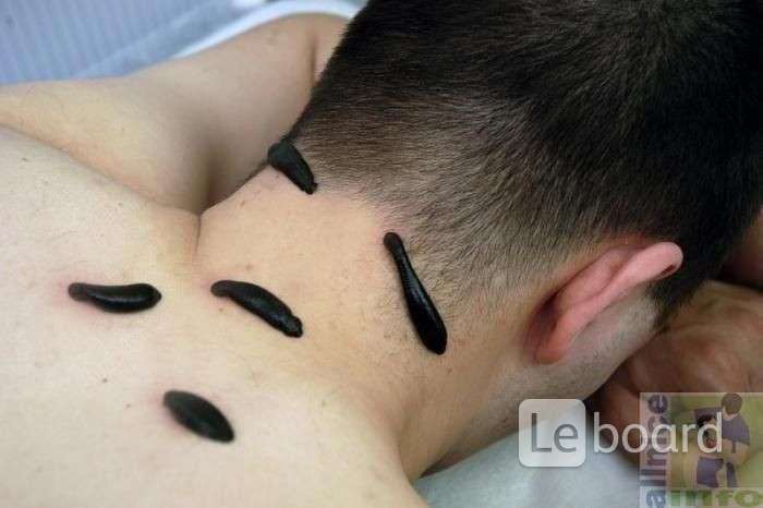 Купить Книгу Лечение Пиявками